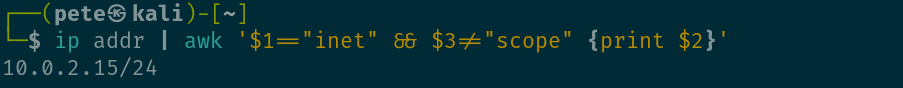 IP of Kali and subnet